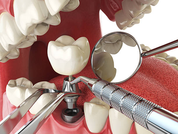 Best Emergency Broken Tooth Repair in Countryside, VA